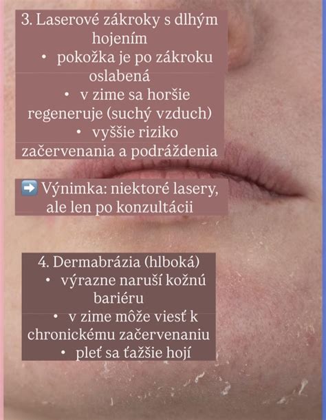 Ilustrácia rôznych štádií kontaktného ekzému s jasným zobrazením začervenania, opuchu a pľuzgierikov