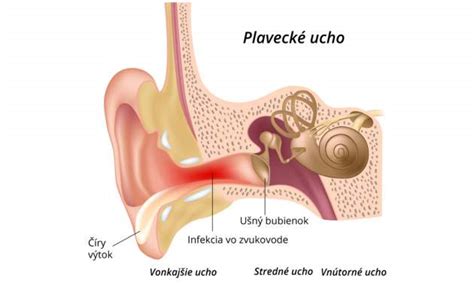 Ilustračná schéma vnútorného a vonkajšieho ucha s vyznačenými oblasťami, ktoré môžu spôsobovať svrbenie.