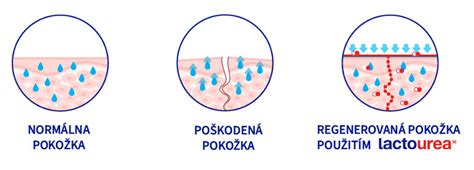 Ilustrácia znázorňujúca štruktúru suchej pokožky a jej potreby hydratácie.