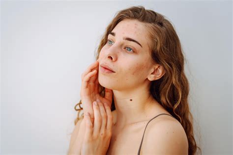 Ilustrácia rôznych typov vyrážok na penise