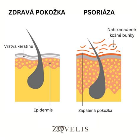 Ilustrácia rôznych typov vyrážok a zápalov na pokožke hlavy.