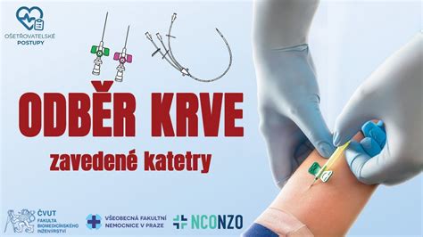 Ilustrácia znázorňujúca testovanie hypoalergénneho produktu na predlaktí