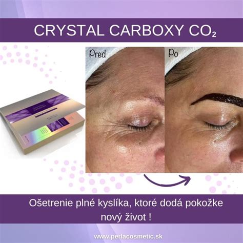 Ilustračná fotografia ženy s hladkou a rozjasnenou pleťou po kozmetickom ošetrení.