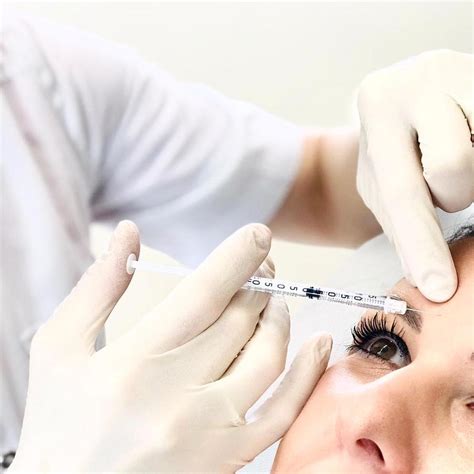 Ilustračná fotografia znázorňujúca mimiku tváre a jej dôležitosť v herectve, kontrastujúca s oblasťami aplikácie botoxu.