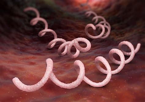 Ilustrácia znázorňujúca baktériu Treponema pallidum, pôvodcu syfilisu.