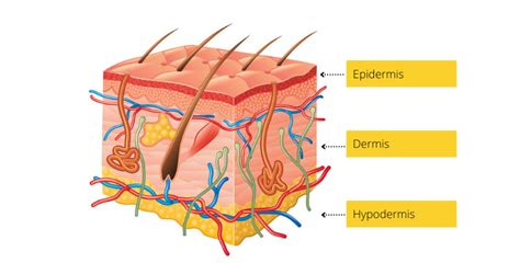 Ilustrácia znázorňujúca vrstvy kože a vznik podkožného akné