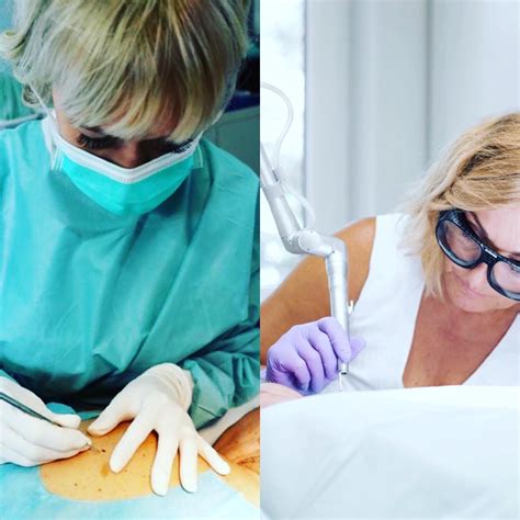 Ilustrácia dermatoskopu a jeho použitia pri vyšetrení znamienka