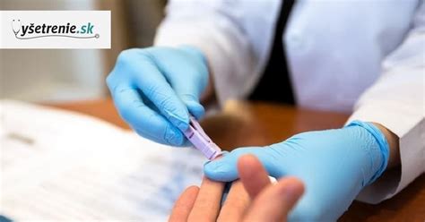 Ilustrácia lekára vykonávajúceho kožný test.