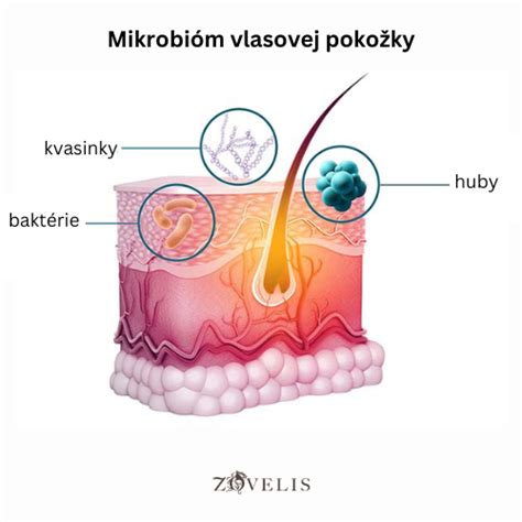 Ilustrácia štruktúry pokožky hlavy s detailným zobrazením vlasových folikulov a mazových žliaz.