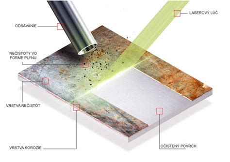 Infografika vysvetľujúca princíp laserového ošetrenia jaziev