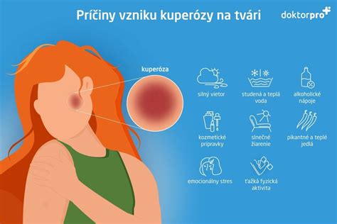 infografika vysvetľujúca príčiny a prejavy rosacey a kuperózy