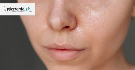 infografika s hlavnými príčinami mastnej pleti: genetika, hormóny, nevhodná starostlivosť, strava, stres