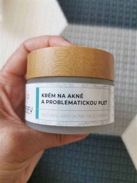 koláž rôznych typov lokálnych ošetrení na akné (zinkový krém, čajovníkový olej, SOS korektor)