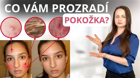 Porovnanie zloženia pokožky pred a po použití micelárnej vody