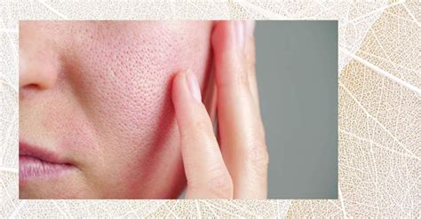 Ilustrácia tváre s viditeľnými negatívnymi vplyvmi alkoholu: začervenanie, opuch, vrásky.