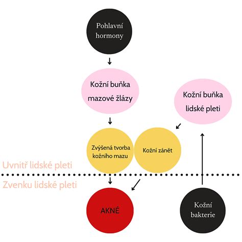 Grafické znázornenie rozdielu v umiestnení akné u dospievajúcich a dospelých