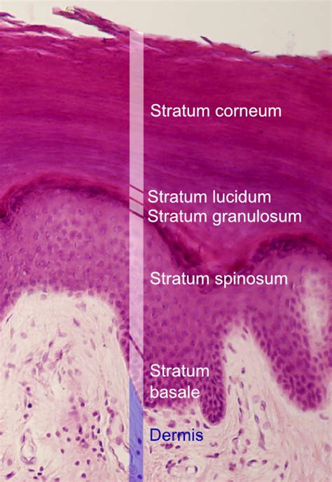 Grafické znázornenie vrstiev epidermis s označením stratum basale, stratum spinosum, stratum granulosum, stratum lucidum a stratum corneum