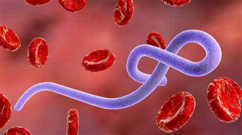 Detailný záber na prsty postihnuté dyshidrotickým ekzémom s viditeľnými pľuzgierikmi