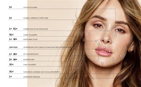 Schéma aplikácie výplne na korekciu brady a dolnej čeľuste