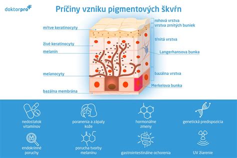 Infografika zobrazujúca rôzne faktory, ktoré môžu prispieť k vzniku ekzému na tvári