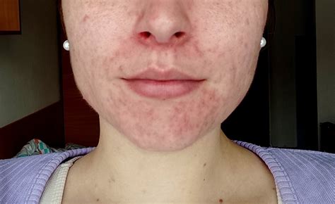 Ilustračná fotografia ženy s rozjasnenou a jednotnou pleťou