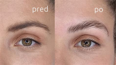Porovnanie pred a po aplikácii permanentného make-upu obočia.