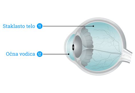 Ilustrácia oka postihnutého alergickou konjunktivitídou.