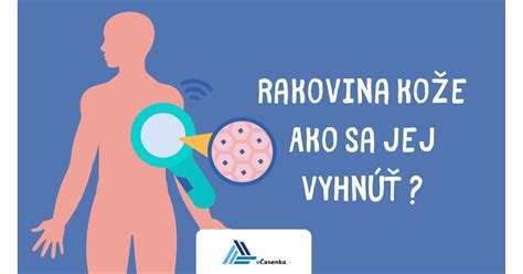 Infografika s najčastejšími rizikovými faktormi pre rakovinu kože