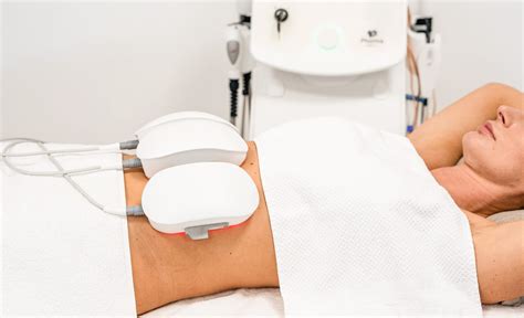 Vizualizácia procesu laserovej lipolýzy s monitorovaním teploty