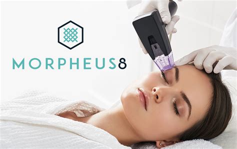 Ilustrácia prenikajúcich mikroihličiek do pokožky, ktoré generujú rádiofrekvenčnú energiu.