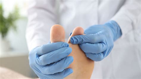 Ilustrácia rizikových miest pre vznik mykózy: priestor medzi prstami, slabiny, podpazušie