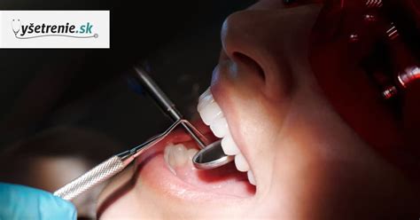 ilustračná fotografia aft v ústnej dutine