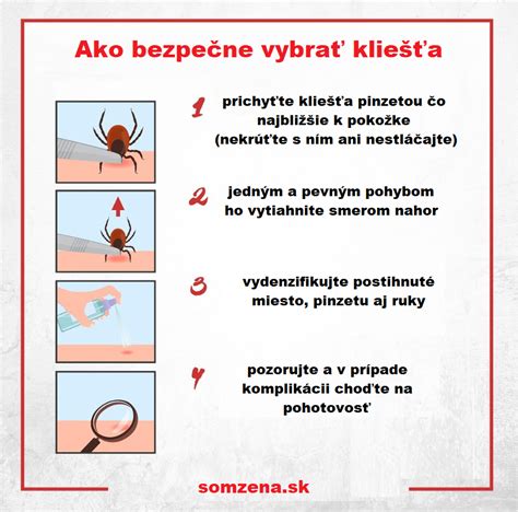 Ilustrácia správneho postupu odstránenia kliešťa pinzetou
