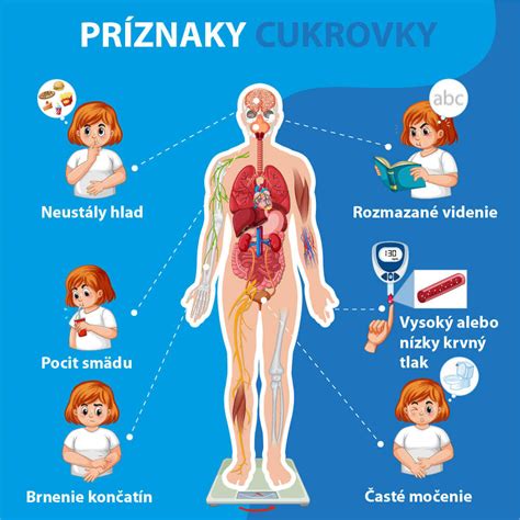 Infografika zobrazujúca typické príznaky hypertyreózy