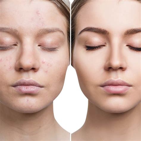 štruktúra pokožky a jej obnova