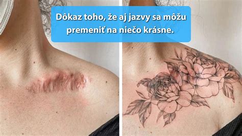 Ilustrácia znázorňujúca bolestivé a nebolestivé jazvy