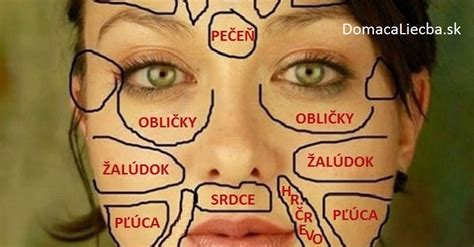 Ilustrácia tváre s problémovou pokožkou a citlivými zónami