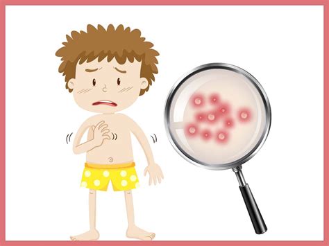 ilustrácia hubovej infekcie kože