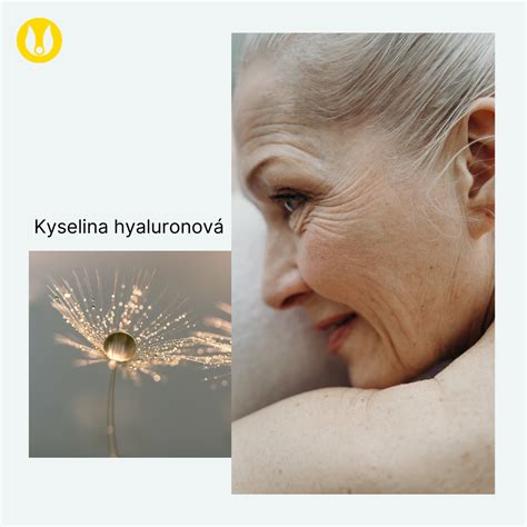 infografika zobrazujúca hydratačné účinky kyseliny hyalurónovej na pokožku