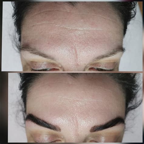 Ilustračná fotografia ženy s jemnou pokožkou po ošetrení