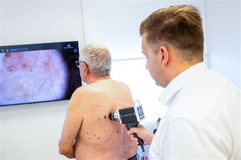 Schéma digitálnej dermatoskopie FotoFinder