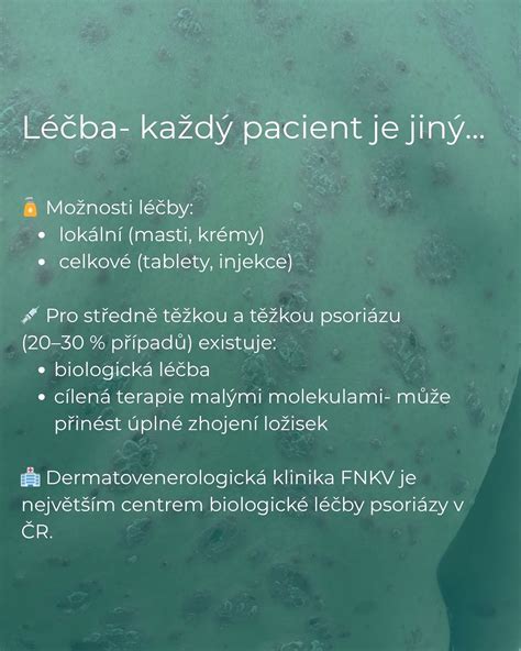 Obrázok znázorňujúci rôzne formy liečby psoriázy, vrátane lokálnej terapie, fotoliečby a biologickej liečby