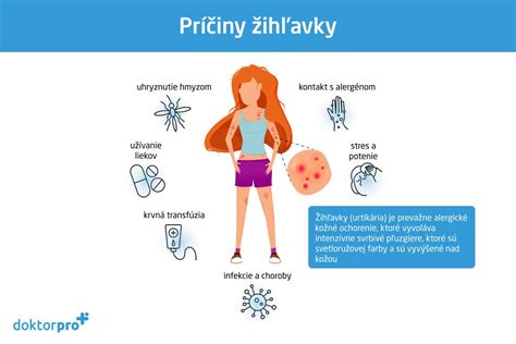 Ilustrácia kožných prejavov žihľavky s červenými vyrážkami a pľuzgierikmi.