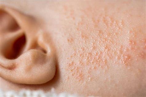 roztomilé bábätko s jemnou kožou na tvári