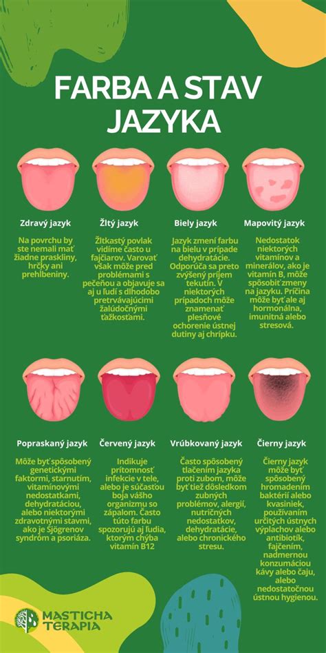 Infografika zobrazujúca rôzne typy zmien na jazyku a ich možné príčiny.