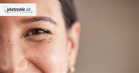 Vizualizácia správneho postupu odlíčenia očí pomocou micelárnej vody a tampónu.