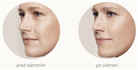 Zobrazenie pokožky pred a po aplikácii samoopaľovacieho krému