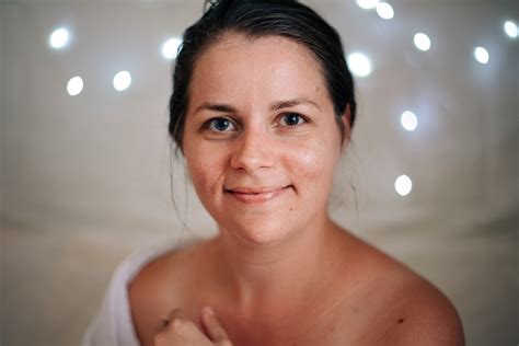 Ilustračná fotografia mladej ženy s pleťou bez lesku