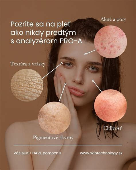 Infografika zobrazujúca rôzne fototypy pleti a ich citlivosť na slnko
