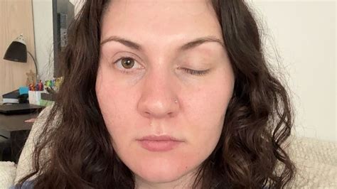 Ilustračná schéma vlasovej kutikuly pred a po aplikácii vlasového botoxu